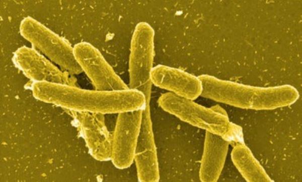 Mỹ điều tra đợt bùng phát các ca nhiễm khuẩn Salmonella Newport