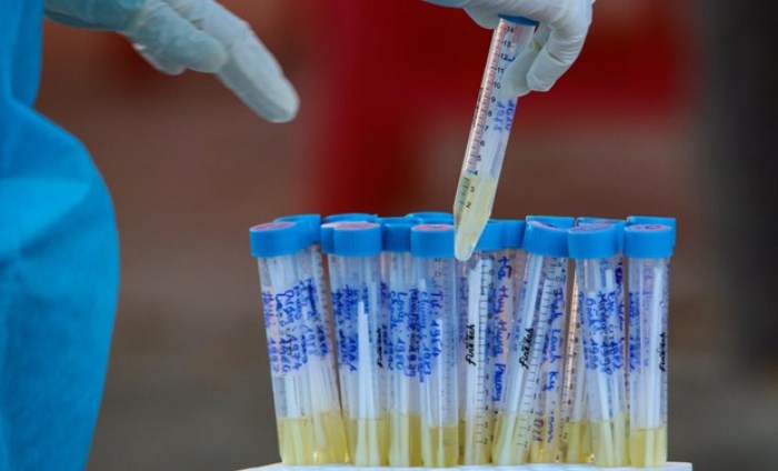 Bộ Y tế: Thêm 2 ca tử vong vì bệnh lý nền nặng và mắc COVID-19