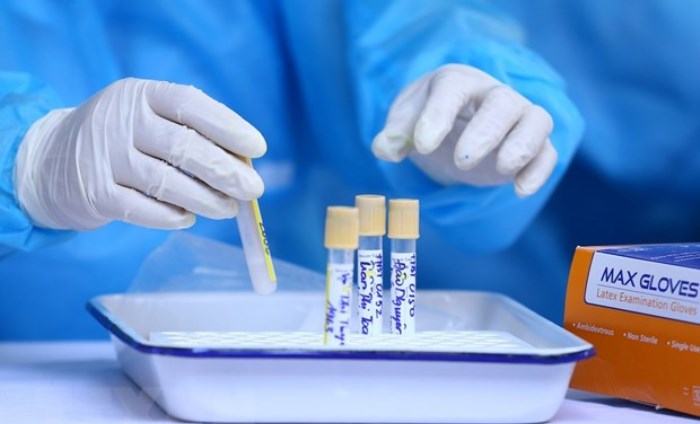 Ca mắc COVID-19 tử vong thứ 35 có kèm theo bệnh lý nền nặng