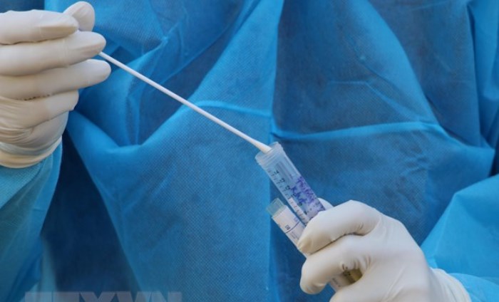 Bệnh nhân COVID-19 thứ 28 tử vong: Suy hô hấp trên nền bệnh thận nặng