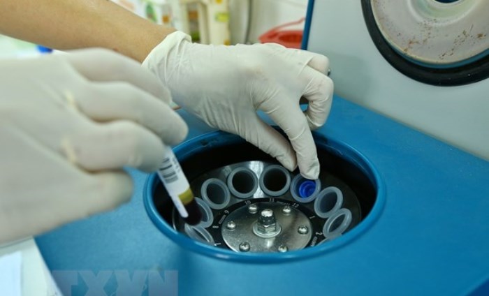 B&aacute;o động t&igrave;nh trạng người Việt Nam thừa cholesterol ở mức cao