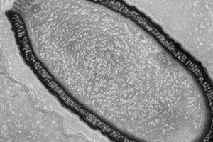 ''Đánh thức'' virus từng tồn tại từ 30.000 năm trước