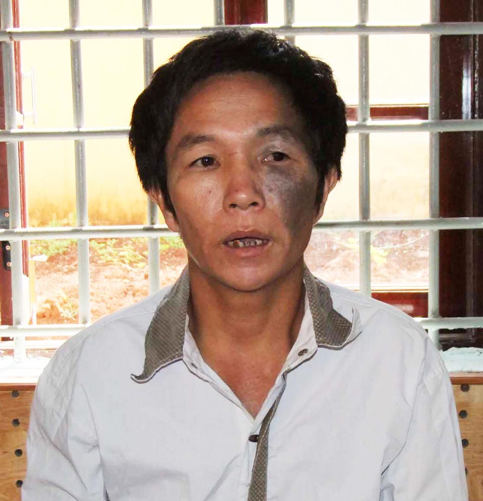 Lật tẩy kẻ trốn truy n&atilde;