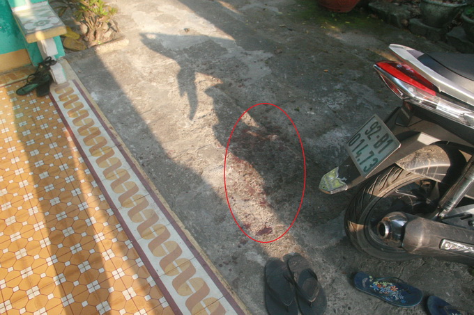 Bắn v&agrave;o m&aacute; người y&ecirc;u rồi chở đi cấp cứu, xong... bỏ trốn 