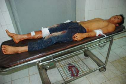 C&ocirc;n đồ đập ph&aacute; nh&agrave; d&acirc;n, ch&eacute;m 3 người trọng thương