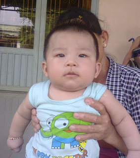 B&eacute; trai hơn 4 th&aacute;ng tuổi bị bắt c&oacute;c đ&atilde; được giải cứu