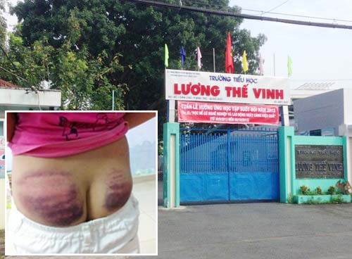 Kinh hoàng bé gái lớp 4 bị thầy giáo bạo hành tàn nhẫn