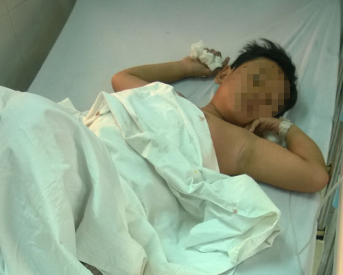 Nghịch súng, một trẻ bị thương nặng