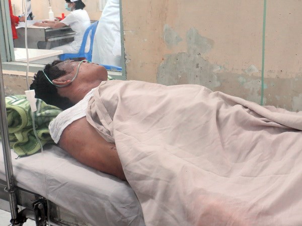 Nạn nhân vụ nổ tại Pomina 3 chưa qua cơn nguy kịch