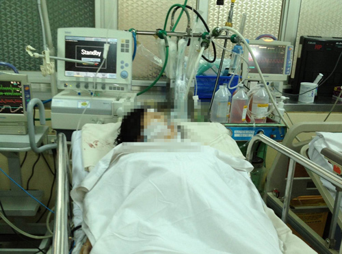 Chồng ch&eacute;m vợ đang mang bầu, thai nhi rơi ra ngo&agrave;i