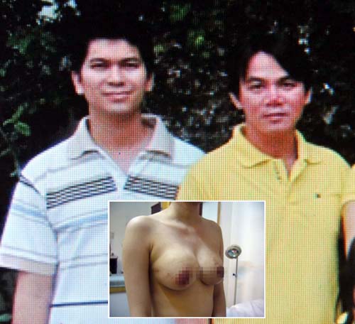 Thẩm mỹ quái dị tái diễn