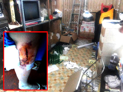 Thẩm mỹ quái dị tái diễn - Kỳ 3: Thêm nhiều nạn nhân tố cáo