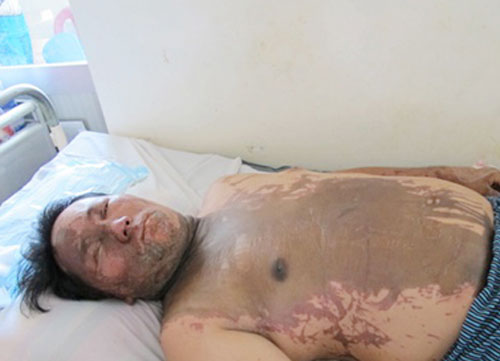 2 chủ nh&agrave; nghỉ bị c&ocirc;n đồ tấn c&ocirc;ng