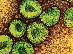 Pháp xác nhận trường hợp thứ hai nhiễm virus corona