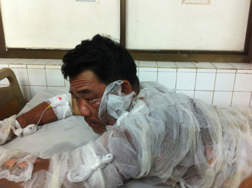 Chạm vào đường dây trung thế, cả khu vực bị cúp điện