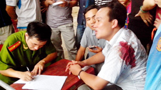 CSGT bất ngờ nổ s&uacute;ng, 2 người bị thương