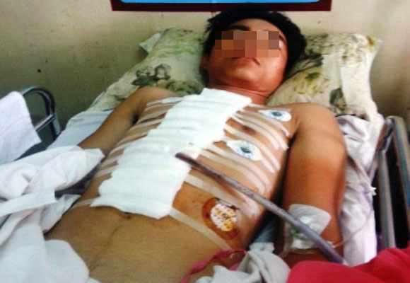 B&igrave;nh Phước: Ghen tu&ocirc;ng v&ocirc; cớ, r&uacute;t k&eacute;o đ&acirc;m "t&igrave;nh địch" gục tại chỗ