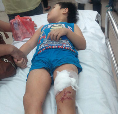 Sập mảng trần trường mầm non 6 cháu bé bị thương