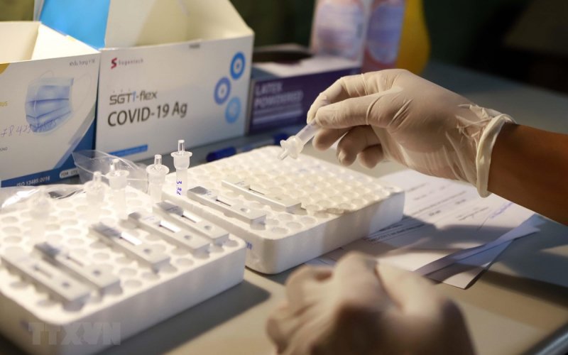 Bình Phước: Kiểm tra việc nhập khẩu, kinh doanh, mua sắm các loại test kit xét nghiệm nhanh và xét nghiệm RT-PCR