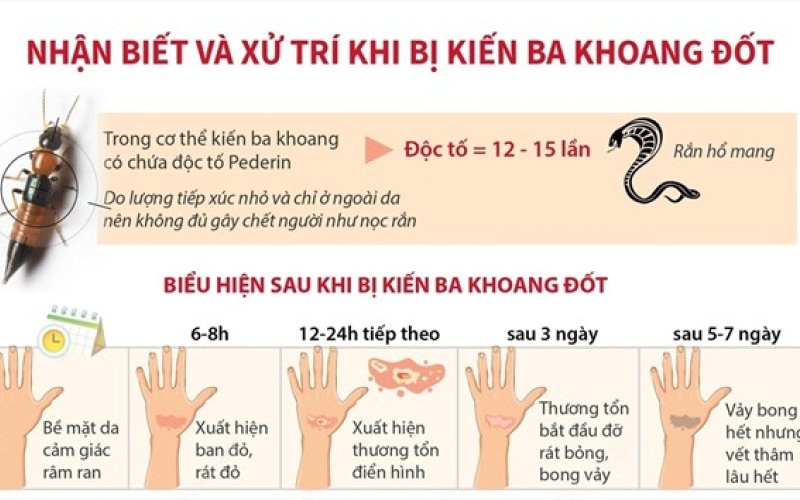 Nhận biết v&agrave; xử tr&iacute; khi bị kiến ba khoang đốt