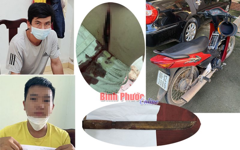 Công an TP. Đồng Xoài: Ngăn chặn vụ chém người trong đêm khuya