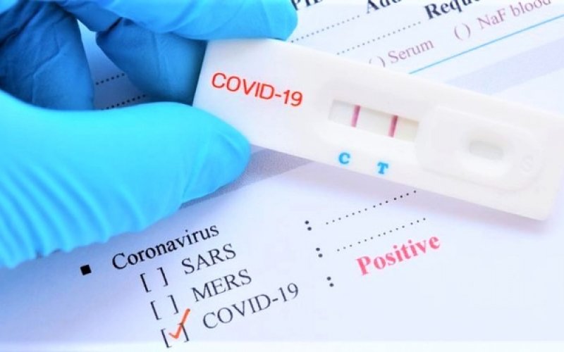 Giá dịch vụ xét nghiệm SARS-CoV-2 trong trường hợp thuộc phạm vi thanh toán của Quỹ BHYT