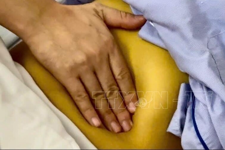 Bước ngoặt trong sàng lọc và điều trị viêm gan virus tại tuyến y tế cơ sở