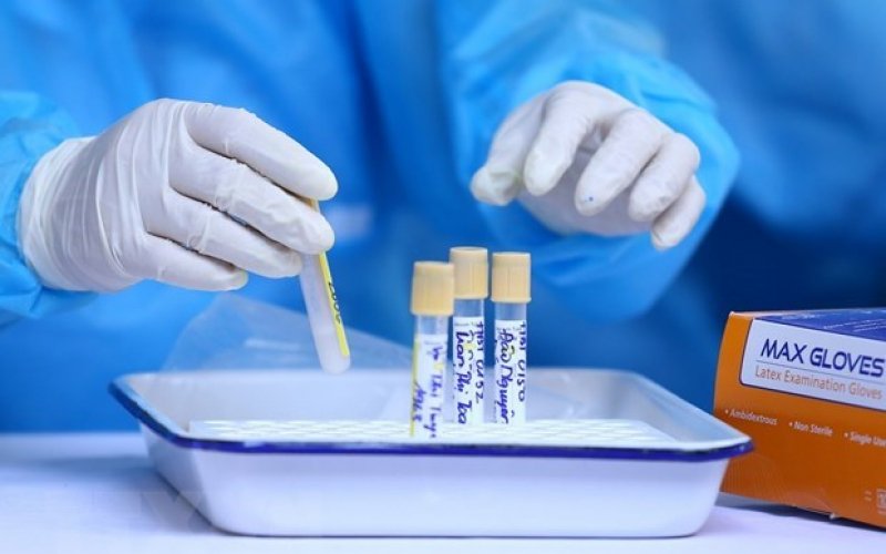 Thêm một ca mắc COVID-19 mới, được cách ly ngay khi nhập cảnh