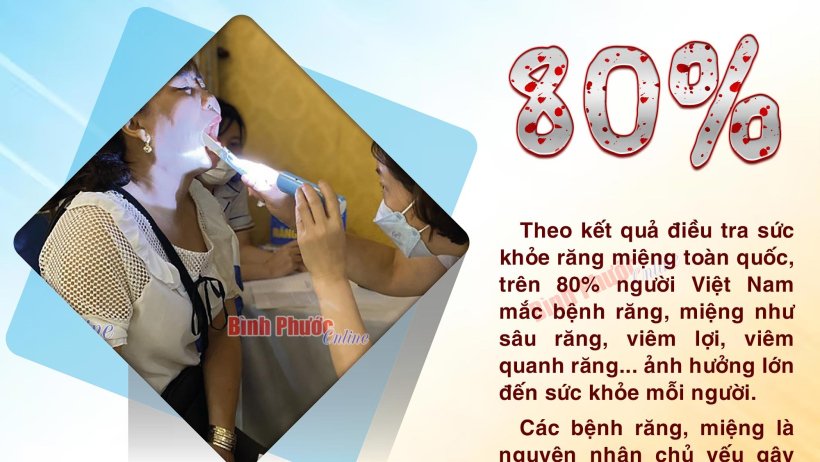 80% người Việt mắc các bệnh về răng, miệng