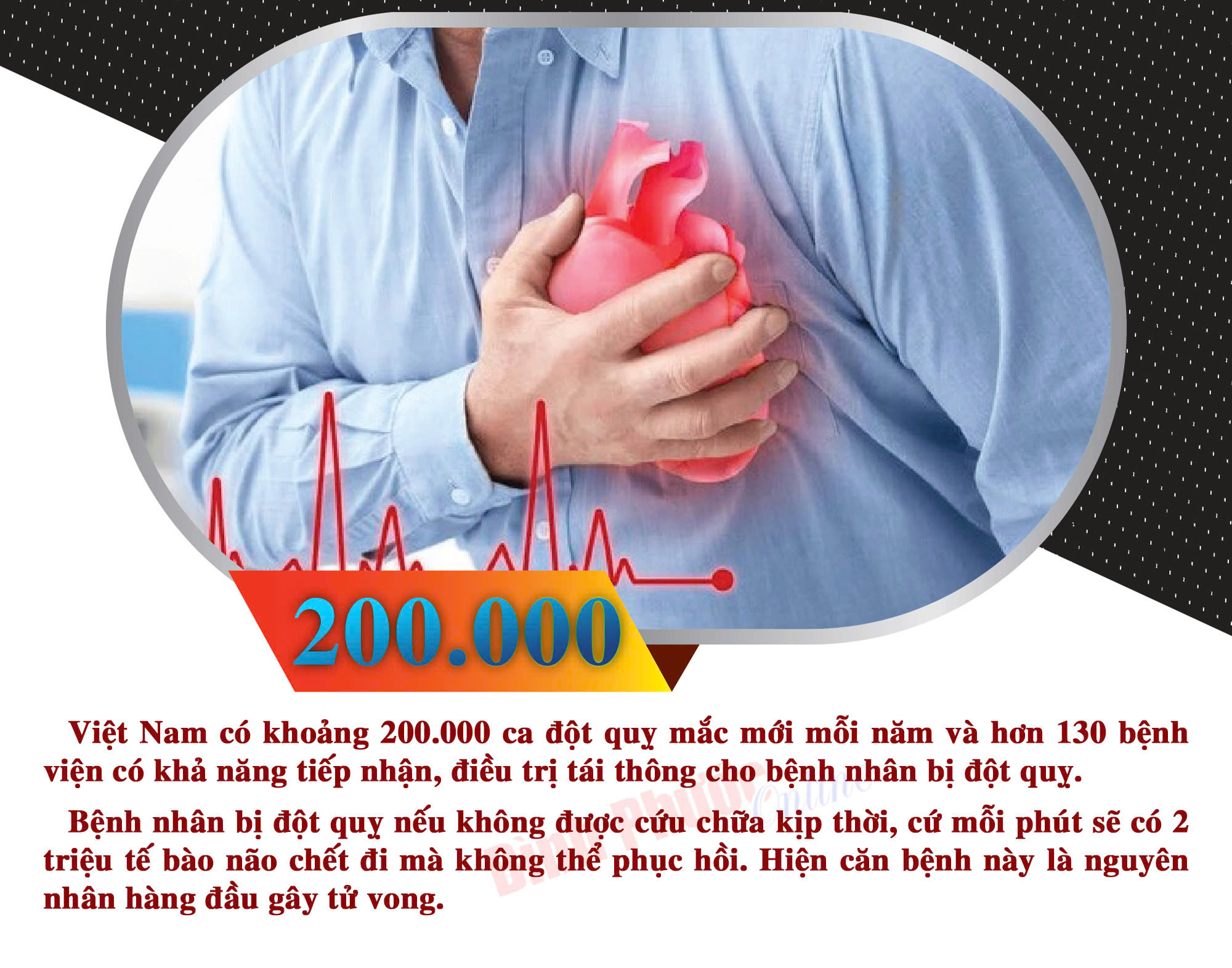 Việt Nam ghi nhận 200.000 ca đột quỵ mắc mới mỗi năm