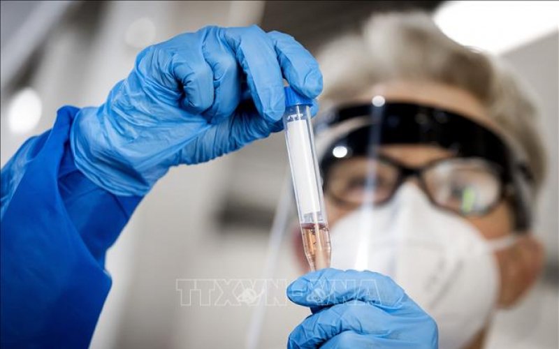 Nga phát triển công nghệ phát hiện virus SARS-CoV-2 ở giai đoạn sớm