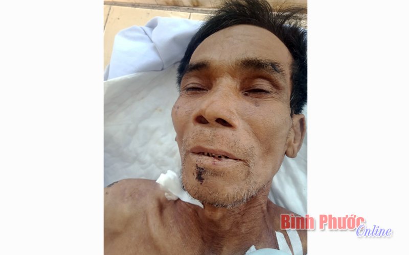 Tìm thân nhân người đàn ông tử vong tại Bệnh viện đa khoa tỉnh Bình Phước