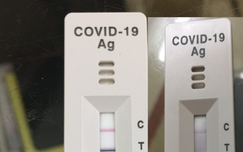 Không nên đánh giá mức độ bệnh qua độ đậm nhạt của que test nhanh COVID-19