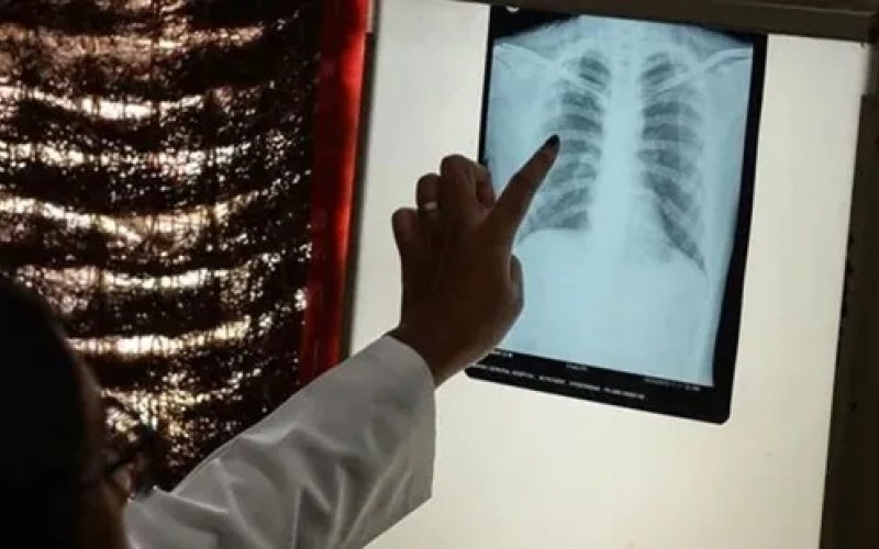 Ngày thế giới phòng chống lao 24-3: Thông điệp của quyết tâm