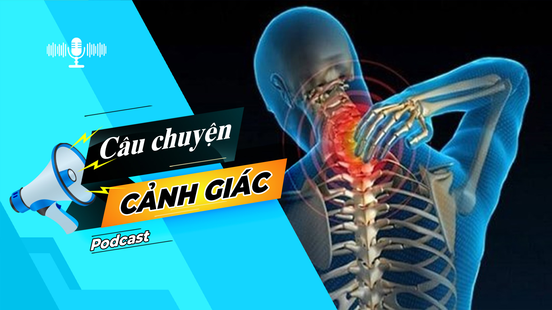 Cẩn trọng với biến chứng của hội chứng đau cổ vai gáy | Câu chuyện cảnh giác