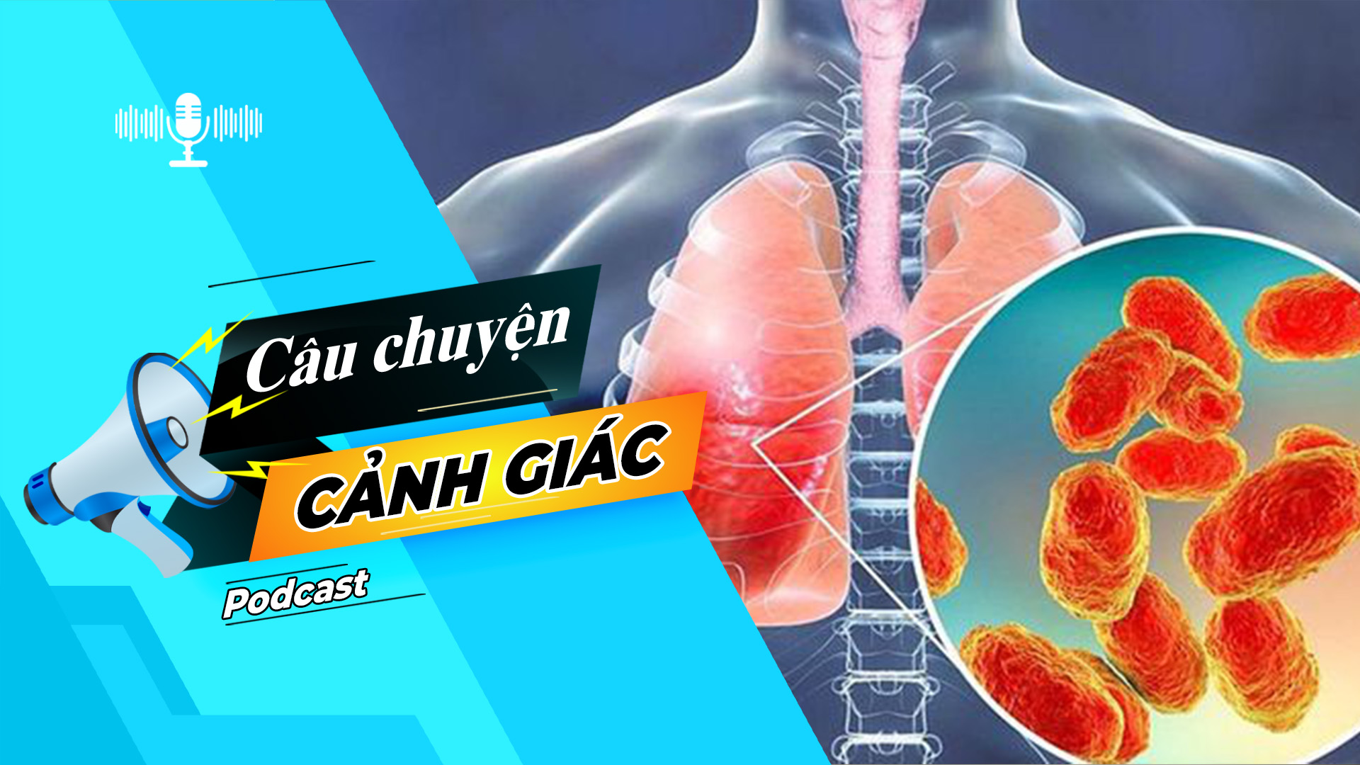 Cảnh giác với bệnh viêm tiểu phế quản ở trẻ | Câu chuyện cảnh giác