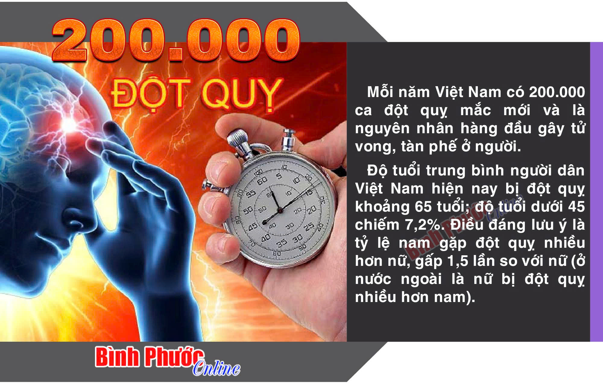 Mỗi năm Việt Nam có khoảng 200.000 ca đột quỵ