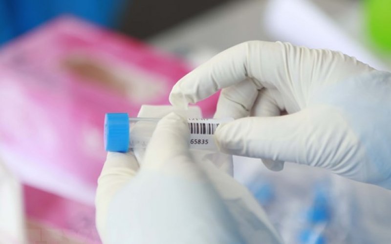 Việt Nam có ca tử vong thứ 47 về COVID-19 là bệnh nhân 22 tuổi