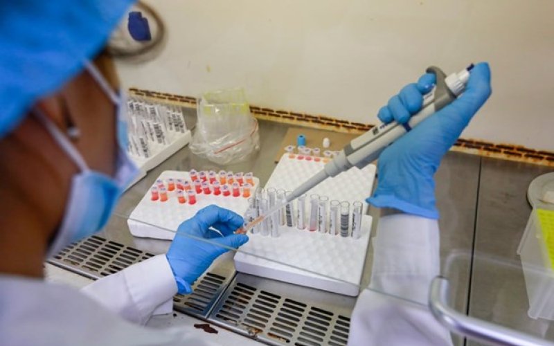 Bộ Y tế thông tin về hình thức đấu thầu hóa chất, đặt máy, mượn máy