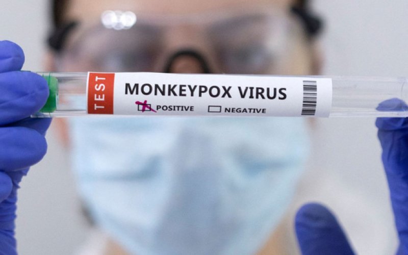 Tăng số ca mắc đậu mùa khỉ tại Bắc Mỹ