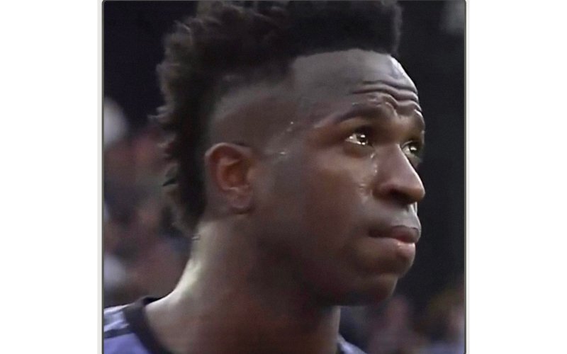 Da của Vinicius màu đen, có gì sai?