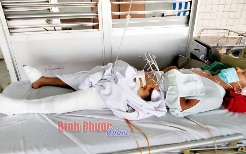 Công an viên gặp nạn lúc bắt cướp rất cần sự giúp đỡ