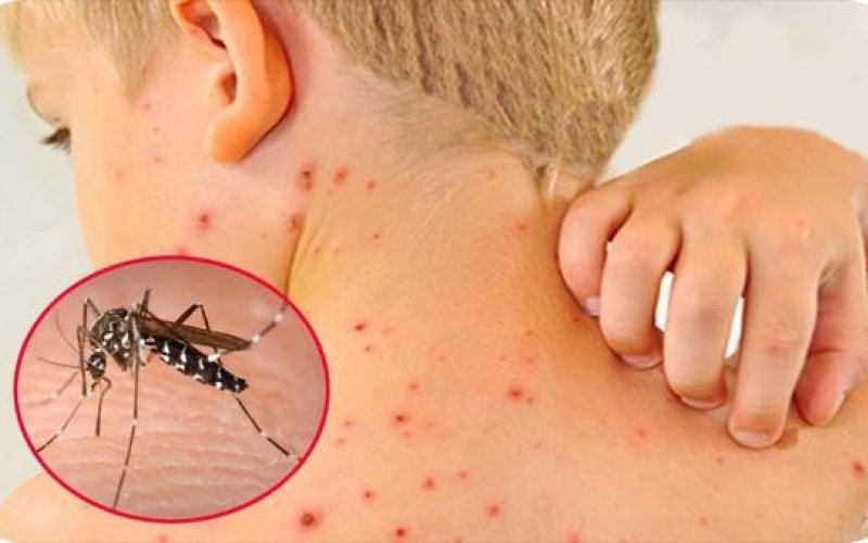 Lạnh lùng sẽ đặt thêm gánh nặng cho ngành y tế 