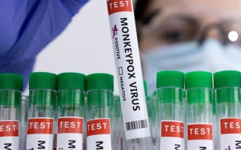 Mỹ điều tra nguồn gốc dịch đậu mùa khỉ lây lan tại nước này