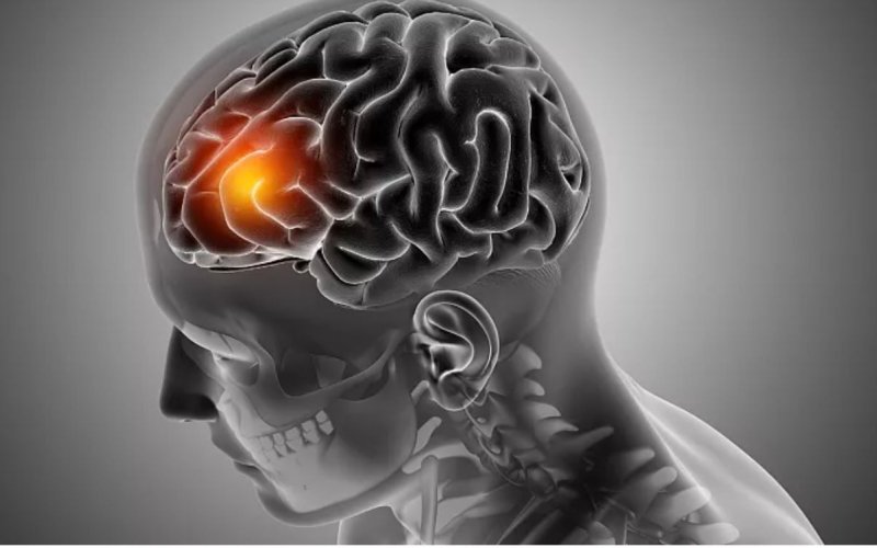 Tìm ra cách khiến tế bào ung thư não tự diệt