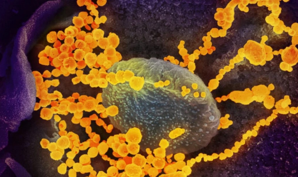 Các biến thể mới của virus SARS-CoV-2 có xu hướng tăng mạnh tại Italy