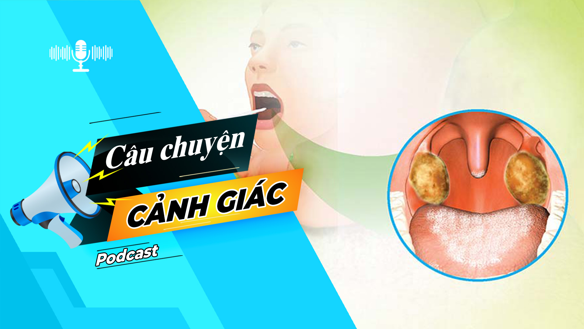 Cẩn trọng với biến chứng của bệnh bạch hầu| Câu chuyện cảnh giác