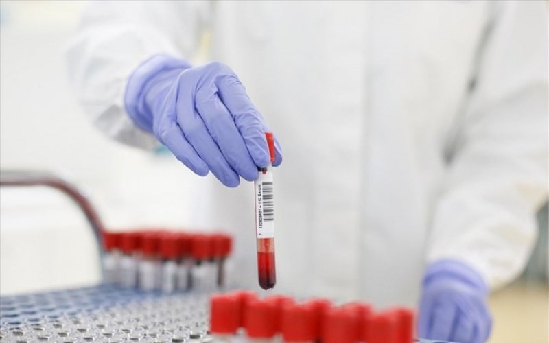 Bộ Y tế hướng dẫn mức giá thanh toán chi phí xét nghiệm COVID-19