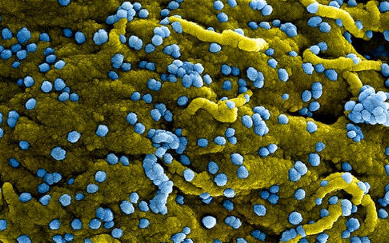 WHO tuy&ecirc;n bố đợt b&ugrave;ng ph&aacute;t loại virus mới