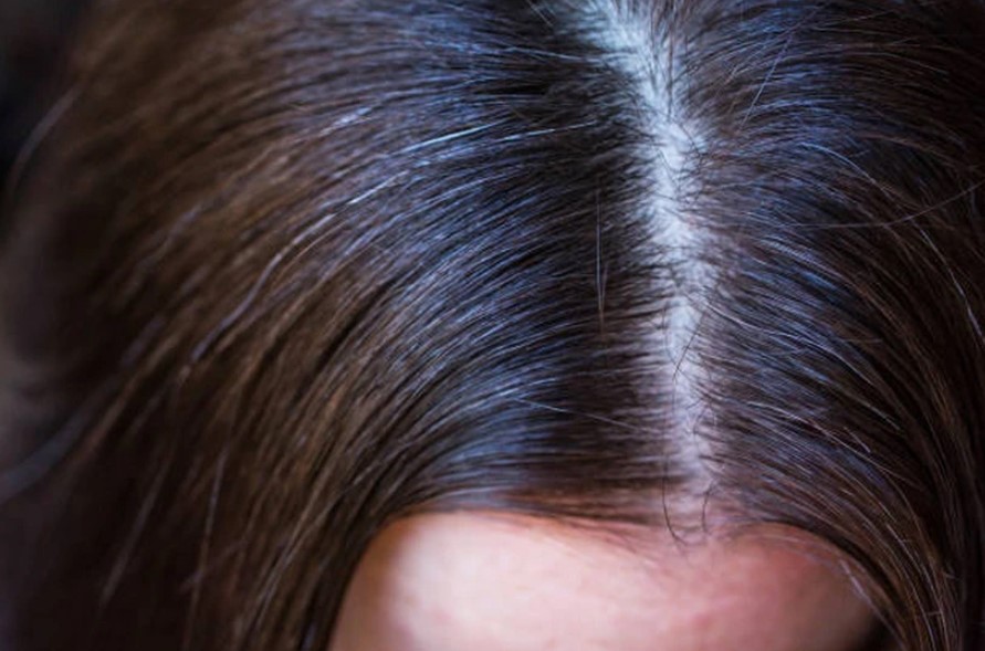 Trẻ em có tóc bạc sớm - dấu hiệu không thể xem thường